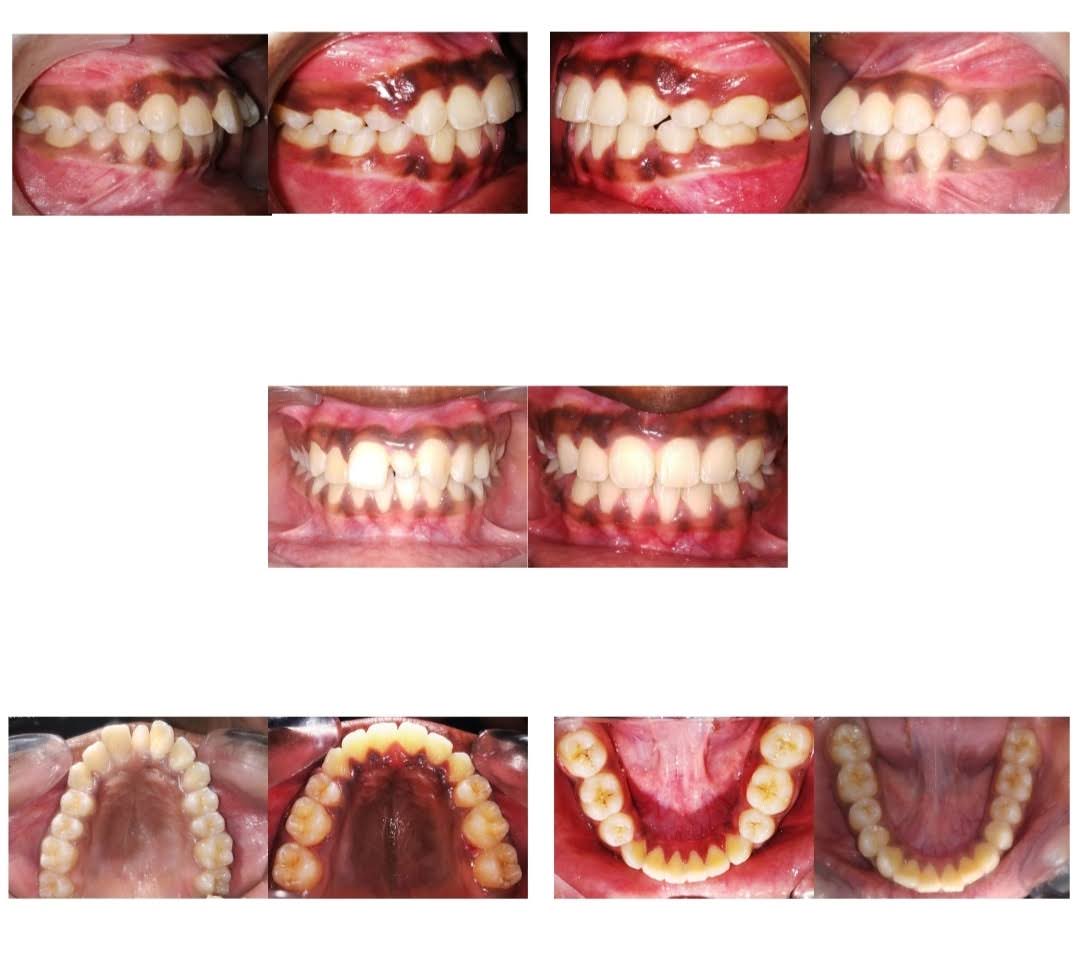 Orthodontic case study