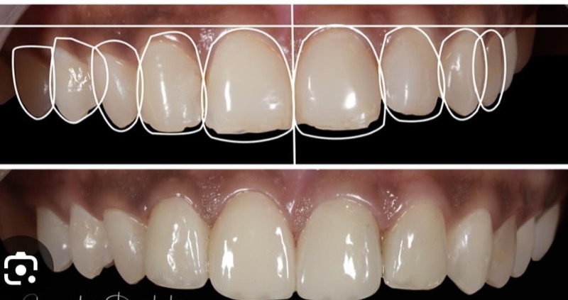 Beautiful smile showcasing cosmetic dentistry results
